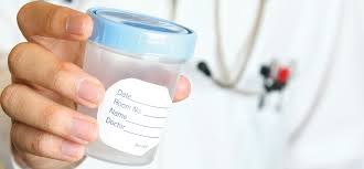 urine drug testing